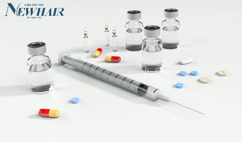 tiêm corticoid trị rụng tóc được không