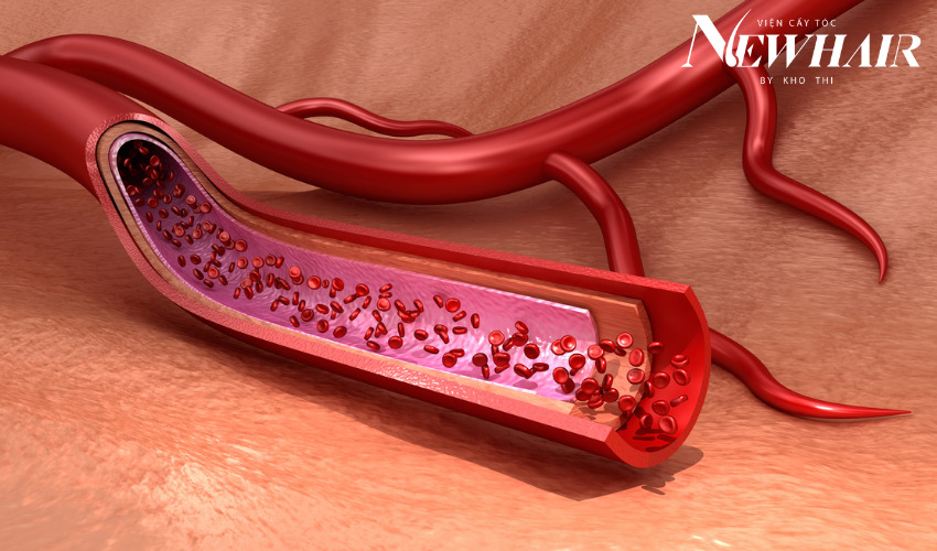 Uống thuốc mọc tóc có hại không