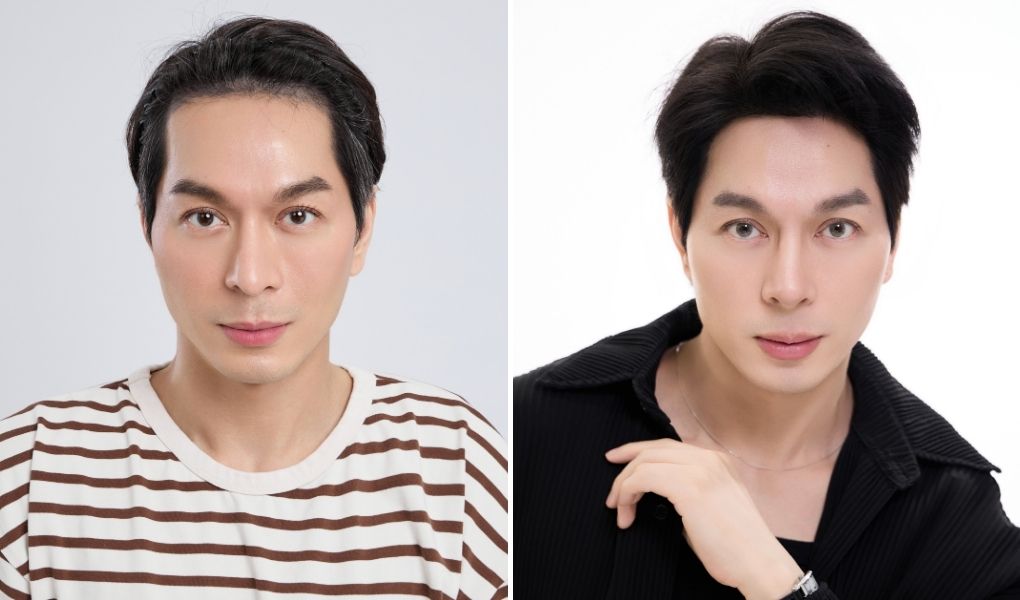 kỳ kỳ cấy hạ đường chân tóc