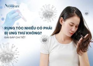 rụng tóc có phải bị ung thư không