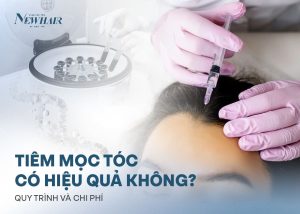 tiêm mọc tóc có hiệu quả không