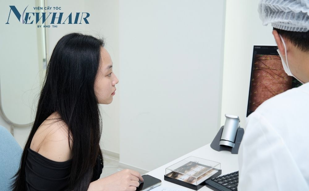 cấy tóc cho nữ