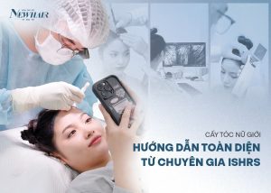 hướng dẫn cấy tóc nữ