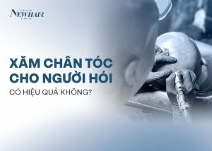 xăm chân tóc cho người hói