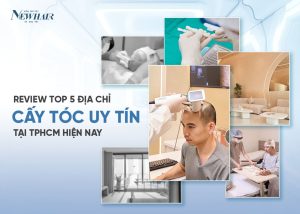 review top 5 địa chỉ cấy tóc uy tín tại TPHCM