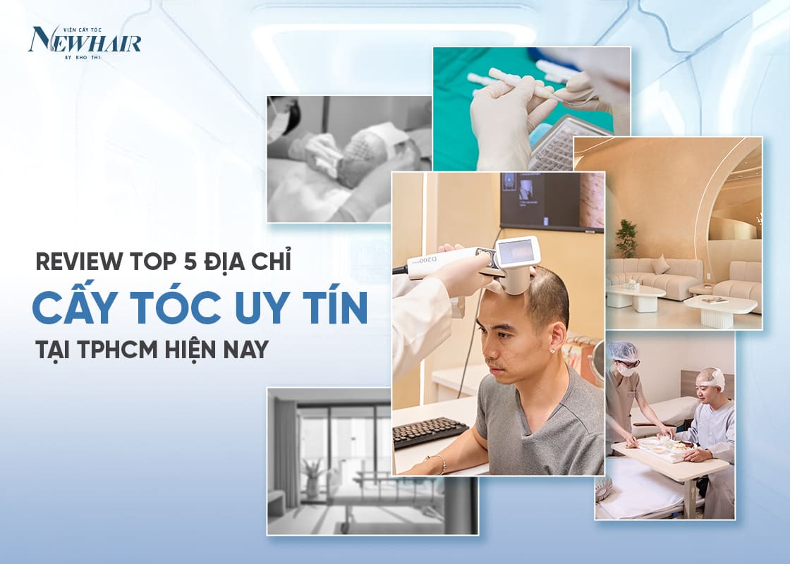 review top 5 địa chỉ cấy tóc uy tín tại TPHCM
