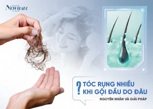 tóc rụng nhiều khi gội đầu