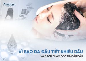 vì sao da đầu tiết nhiều dầu