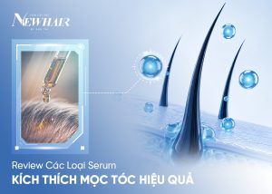 các loại serum kích thích mọc tóc