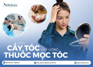 nên chọn cấy tóc hay uống thuốc mọc tóc
