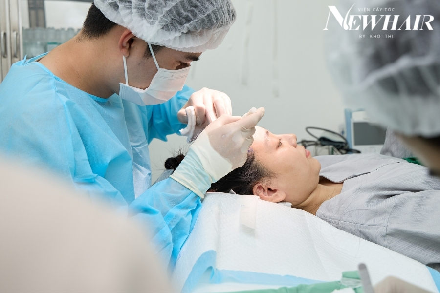 cấy tóc có an toàn không