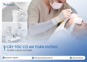 cấy tóc có an toàn không