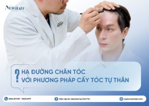 hạ đường chân tóc là gì