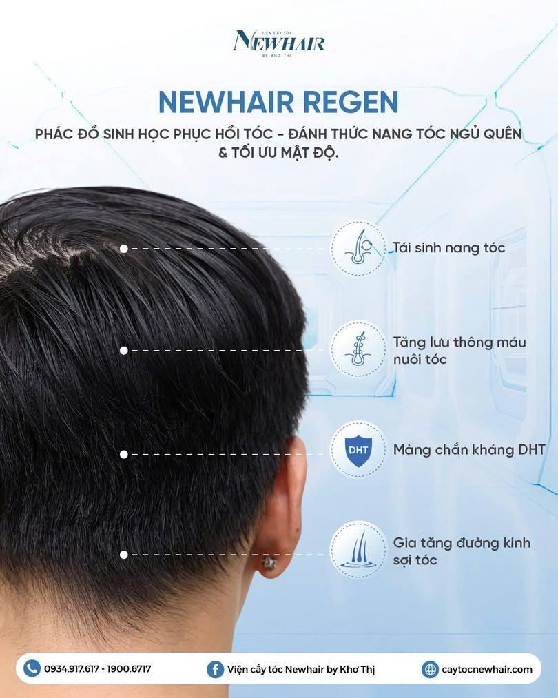 newhair regen