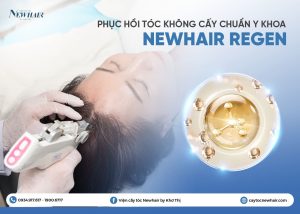 phục hồi tóc không cấy NEWHAIR REGEN