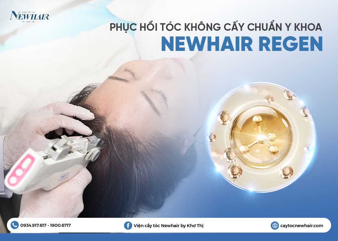 phục hồi tóc không cấy NEWHAIR REGEN
