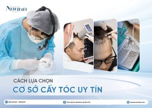 cách lựa chọn địa điểm cấy tóc uy tín