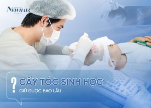 cay toc sinh hoc duoc bao lau