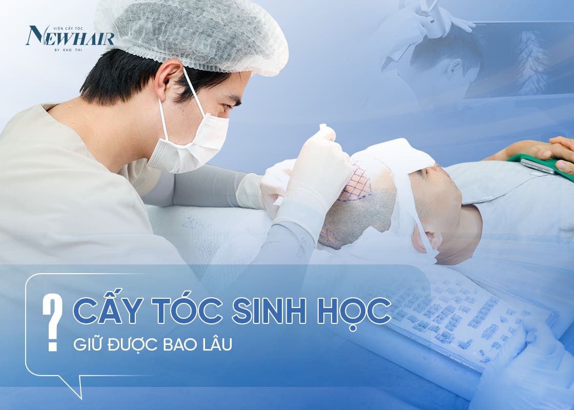 cay toc sinh hoc duoc bao lau