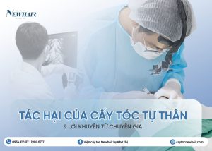 tác hại của cấy tóc tự thân